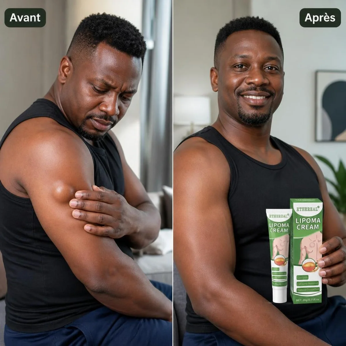 Éliminez vos lipomes et boules de graisse naturellement sans chirurgie 🇧🇯 4