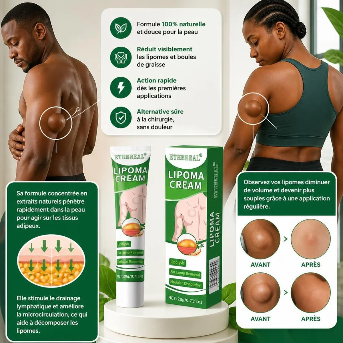 Éliminez vos lipomes et boules de graisse naturellement sans chirurgie 🇧🇯 2